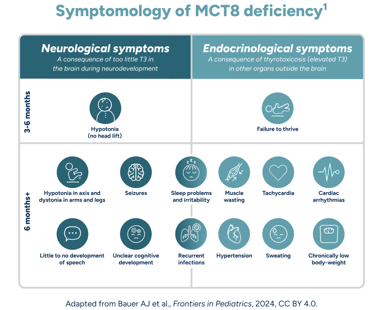 Symptoms of MCT8 deficiency chart.